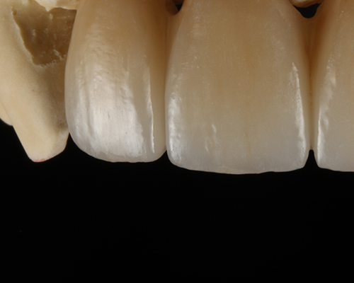 Cosmetic Ceramics UK | Kent | Digital Dentistry | Cosmetic Dentistry | Crowns & Bridges | Implants | Metal Free Dentistry